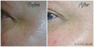 Review of Valentia Even Glow Serum - Before and After Photo EclecticEvelyn.com