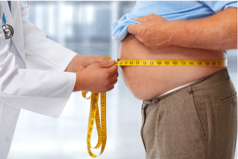 doct measuring obese mans stomach