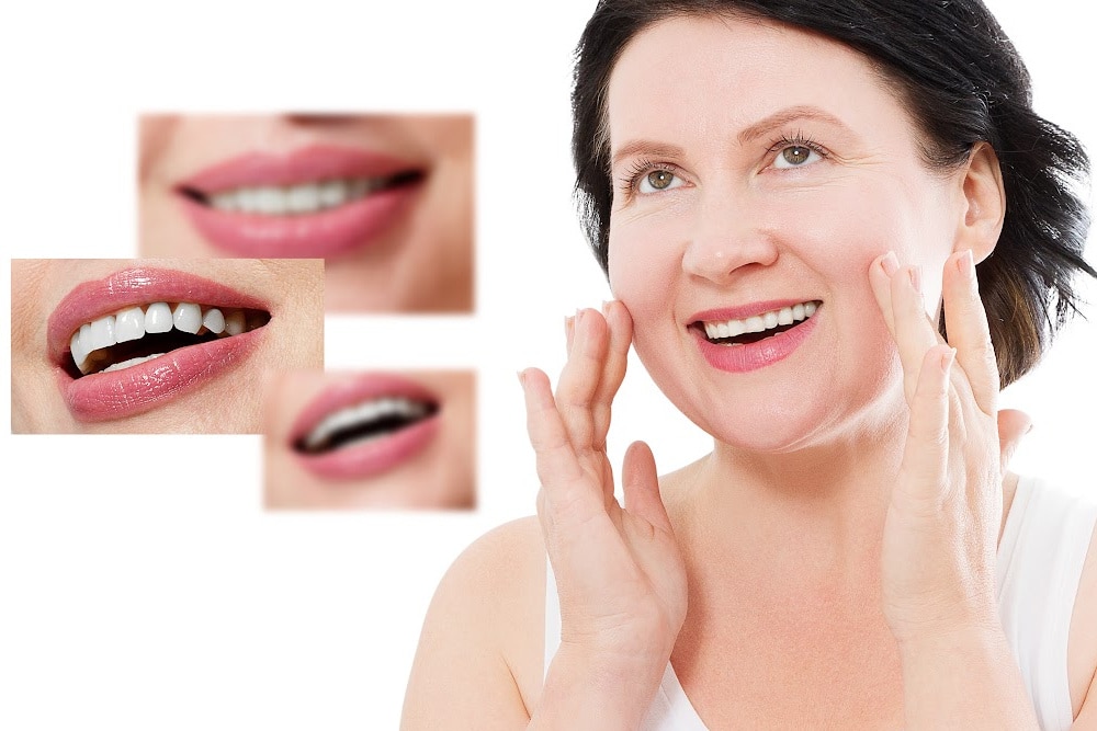 woman over 40 showing off her veneers 3 close up photos of the dental restoration